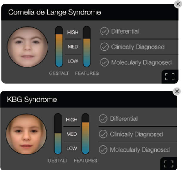 Plataforma Face2Gene
