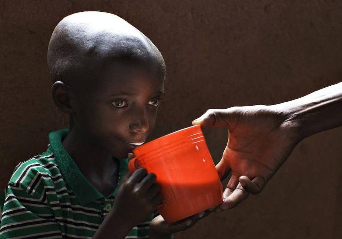 Un niño con desnutrición bebe leche en un centro de Congo