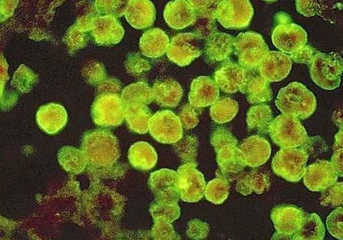 Imagen de archovo de la ameba comecerebros