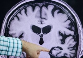 El alzhéimer podría prevenirse con un alimento para la musculación