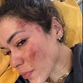 Fernanda, la española agredida sexualmente en la India: «Pensaba que íbamos a morir»