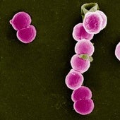 Europa alerta sobre el «preocupante» aumento de la resistencia a los antimicrobianos en la gonorrea