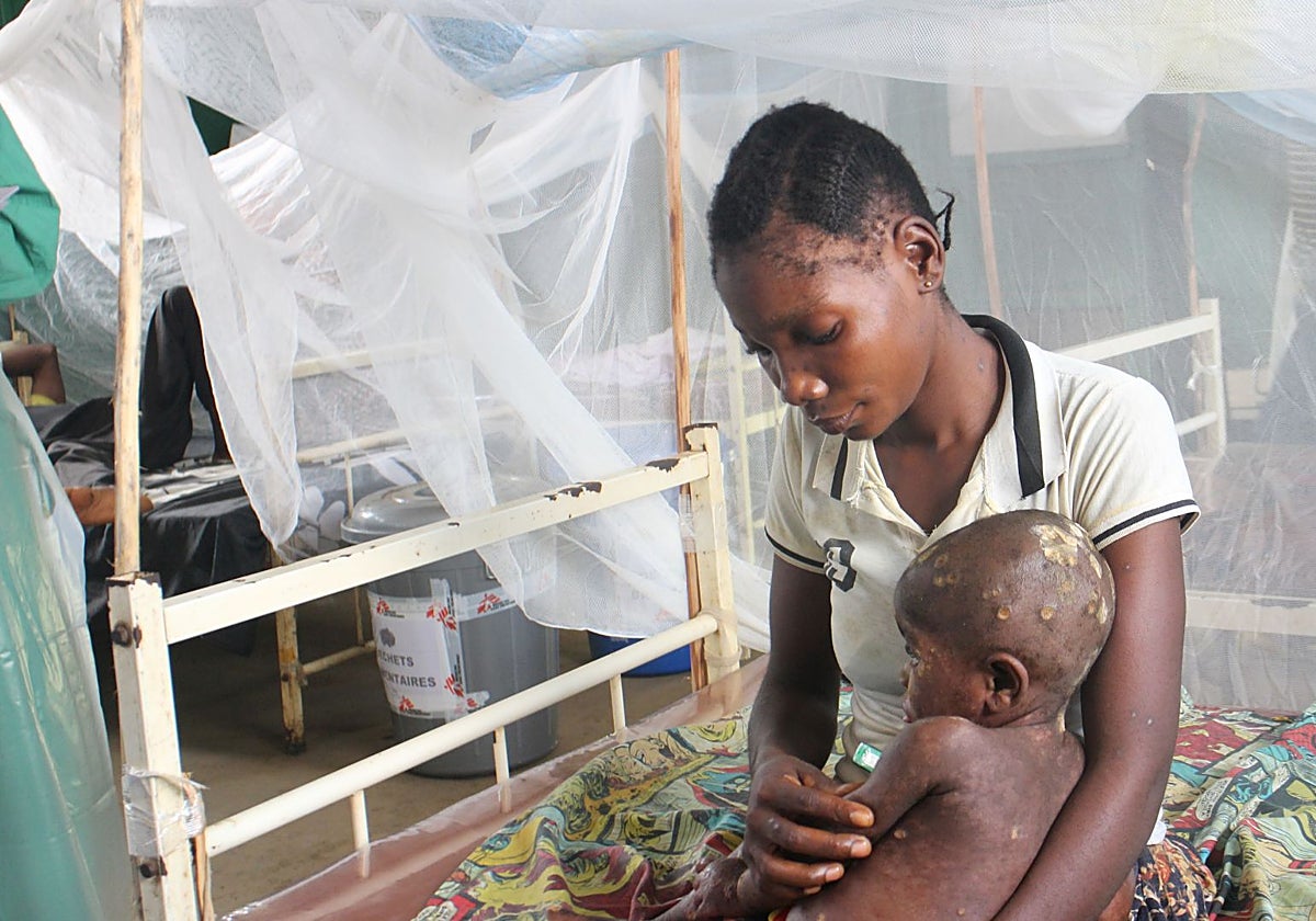 Un niño de 1 año que tiene mpox en brazos de su madre, hospitalizado en el hospital general de Bolomba (República Democrática del Congo)