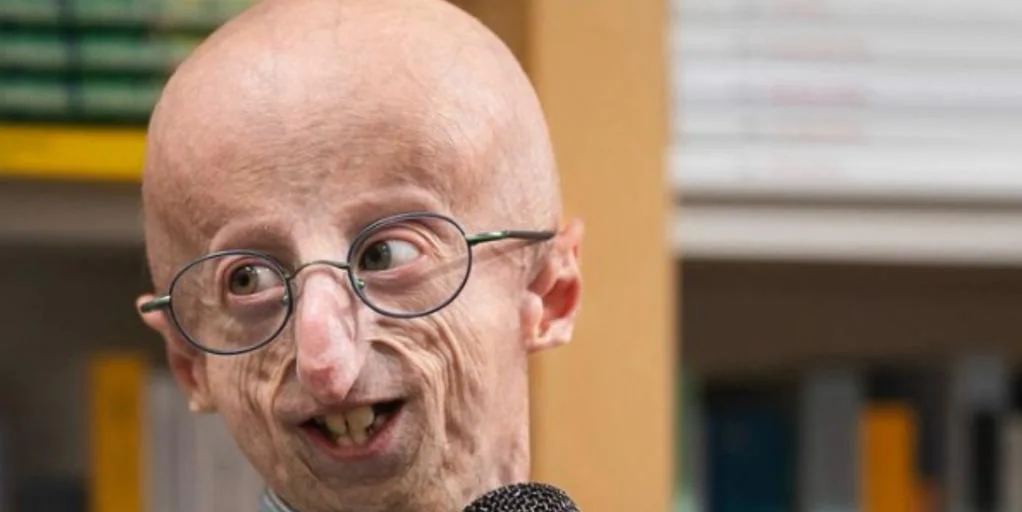 Sammy Basso, the world’s oldest person with progeria, dies at 28