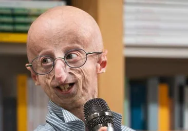 Muere Sammy Basso a los 28 años, la persona con progeria más longeva del mundo