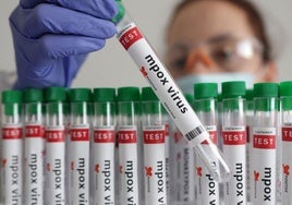 Reino Unido informa de los primeros contagios locales de la nueva variante de viruela del mono fuera de África