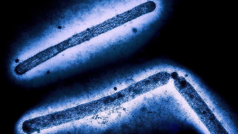 El virus h5N1 visto en un microscopio electrónico