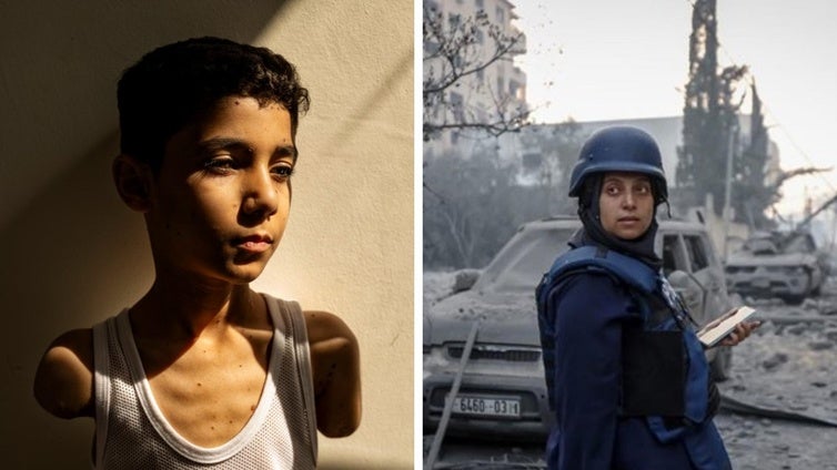 La fotografía de un niño gazatí con los brazos mutilados por la explosión de un proyectil israelí, ganadora del World Press Photo 2025