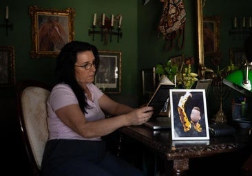 Madre de una víctima de la finasterida: «Si el fármaco estuviera prohibido, mi hijo igual seguiría con vida»