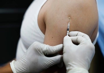 Paciente fallecido por viruela del mono con VIH avanzado