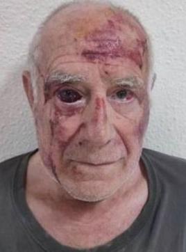 Imagen - Estado en el que quedó Domingo tras la paliza.