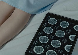 Cuidar sin perderlo todo: la prestación CUME, un derecho pionero que protege a las familias