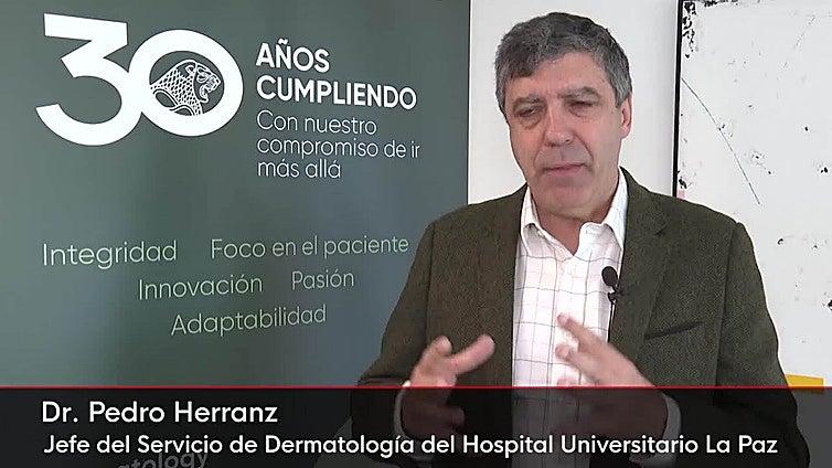 Se lanza en España un nuevo tratamiento para adultos con eccema crónico de manos