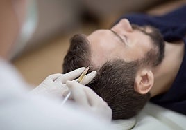 Inyecciones de bótox, lo nuevo para combatir la calvicie común