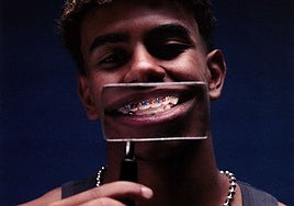 La nueva ortodoncia con joyas de Lamine Yamal lleva los colores del Barcelona