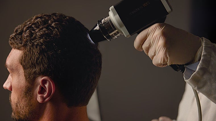 Diagnóstico capilar en SHA España.