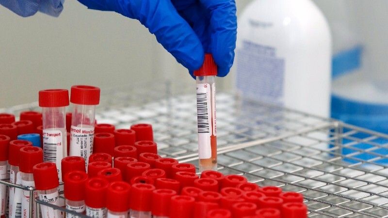 Huelva suma tres nuevas muertes y 297 casos de Covid-19 en las últimas 24 horas