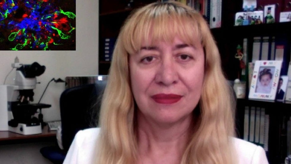 Conferencia en Huelva para analizar los mecanismos que condicionan el Alzheimer