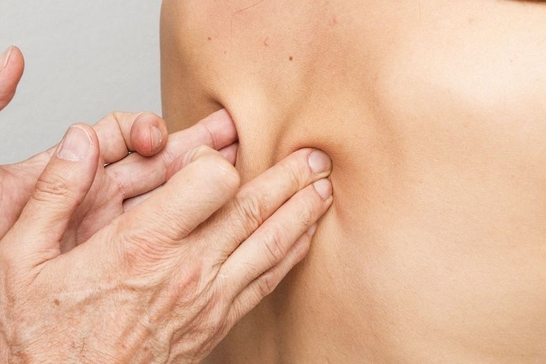 Cómo aliviar el dolor causado por una hernia discal