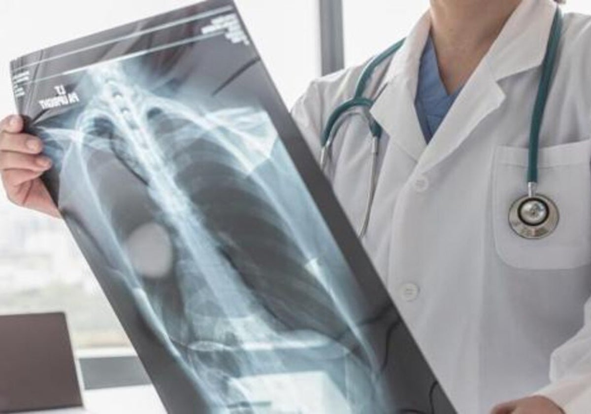 Una doctora observa una radiografía de tórax