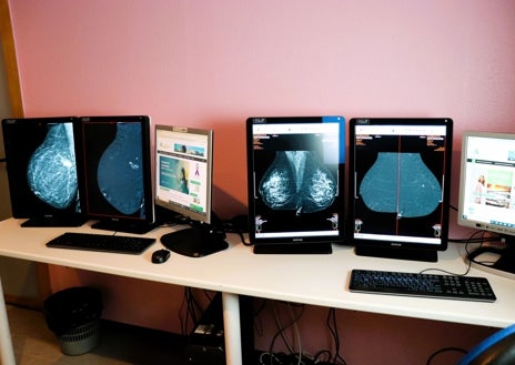 Imagen secundaria 1 - El Juan Ramón Jiménez incorpora la última tecnología para la detección del cáncer de mama