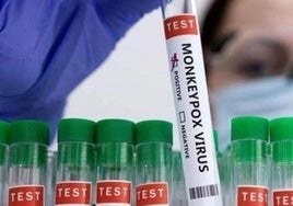 Salud notifica dos posibles casos de viruela del mono detectados en Lepe