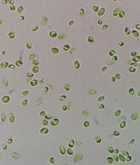 Imagen secundaria 2 - Descubren el poder antiinflamatorio de una microalga del río Tinto