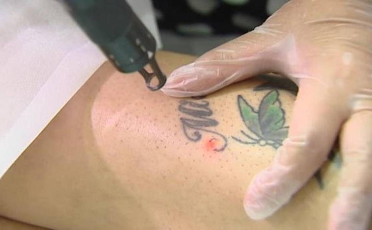 Doce casos de viruela del mono relacionados con un local de tatuajes de San Fernando