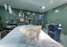 El Hospital Universitario Puerta del Mar impulsa una comisión sobre planificación quirúrgica e impresión 3D