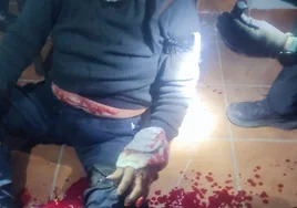 Guardias civiles de Chiclana salvan la vida a un hombre evitando que se desangre tras acuchillarse en una pelea con su hijo