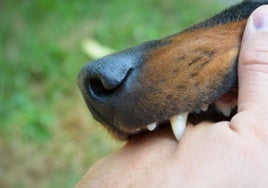 Brutal agresión a un menor que es golpeado y mordido por un perro para robarle el patinete en Algeciras