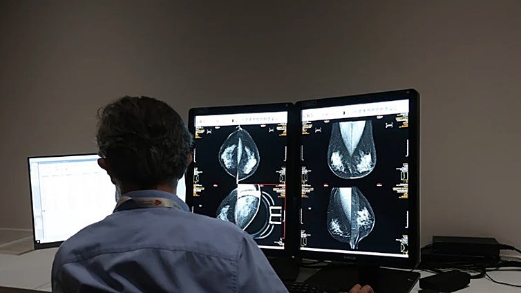 Un total de 200 mujeres del Hospital de Jerez serán citadas para completar el cribado del cáncer de mama dentro del plan de choque de la Junta