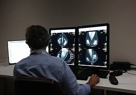 Un total de 200 mujeres del Hospital de Jerez serán citadas para completar el cribado del cáncer de mama dentro del plan de choque de la Junta