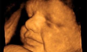 Ginecólogos DAV entrega a Jiménez ecografías de fetos de 12 semanas de gestación