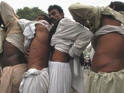 El tráfico de órganos está detrás de 7.000 trasplantes renales en el mundo