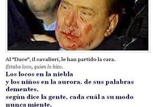 Alonso no reprende a Pérez Castell escudándose en que no ha leído su blog