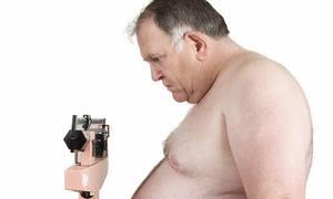 La obesidad mórbida puede tener un origen genético