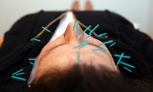 Terapias alternativas en la consulta del médico