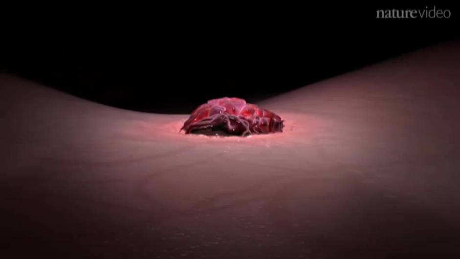 Enfermos de cáncer piden ayudas para investigación