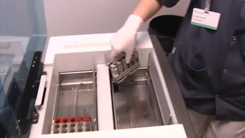 La hepatitis aguda infantil contabiliza ya 190 casos en el mundo