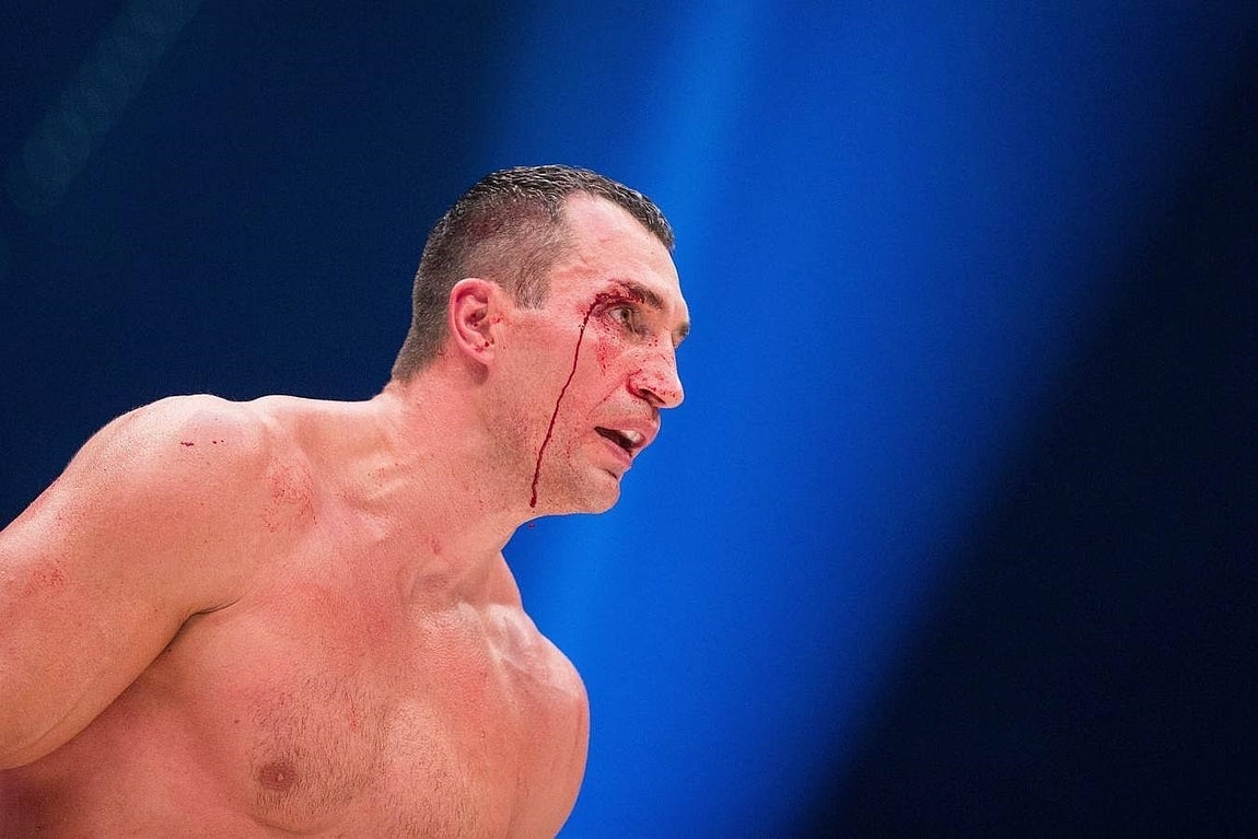El combate Fury-Klitschko, en imágenes