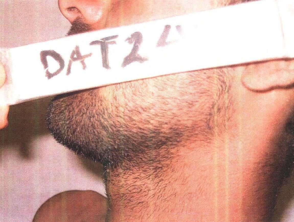 Detalles de las torturas sufridas por los detenidos por militares estadounidenses. 