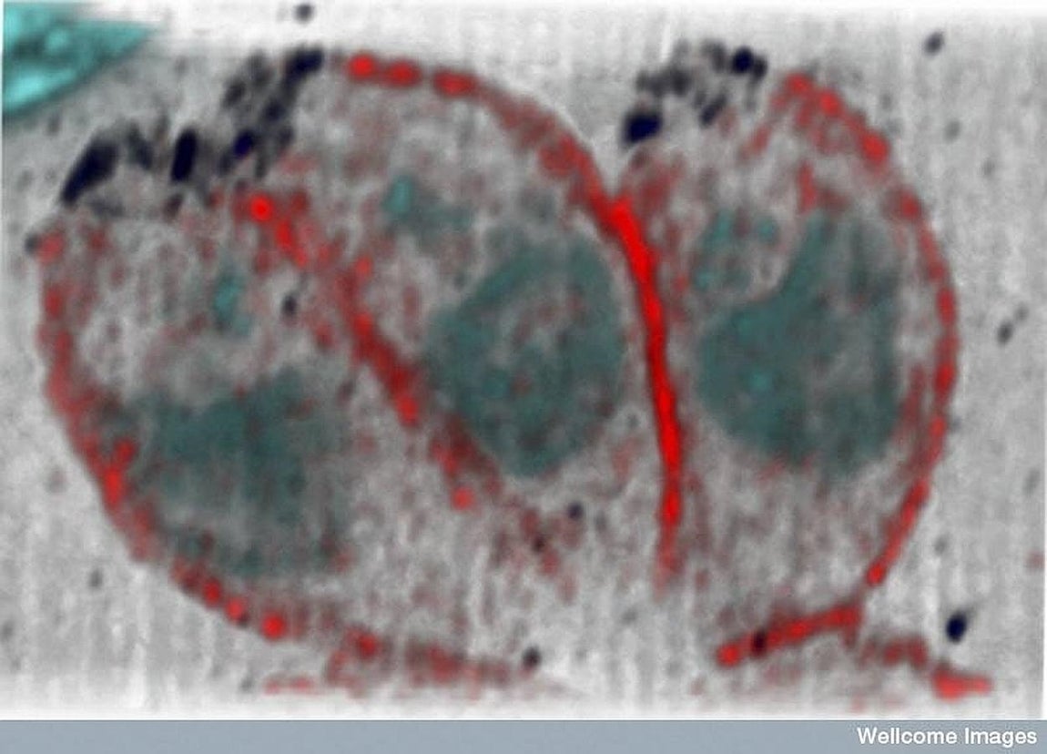 Parásitos causantes de la toxoplasmosis. 