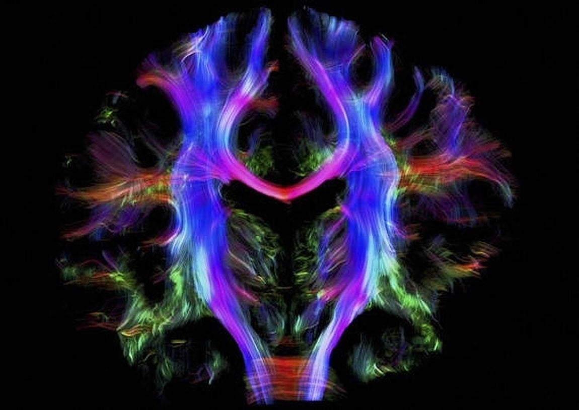 Red neural del cerebro. 