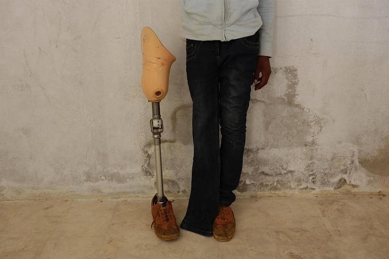 Un hombre posa junto a la prótesis que los dos amigos sirios han preparado para él
