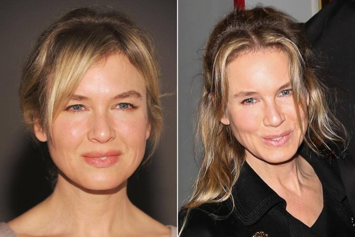 Renée Zellweger. 