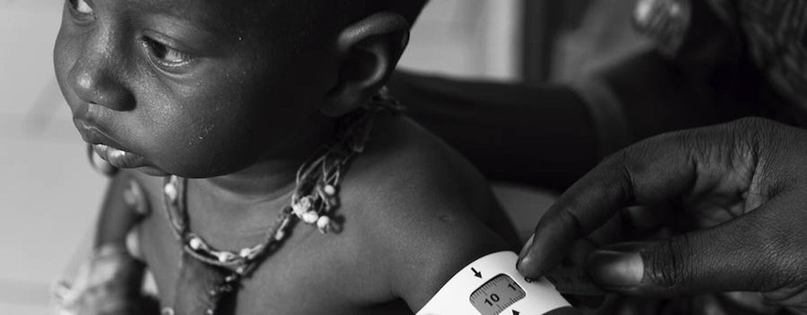 10,3 centímetros (apenas el perímetro de una moneda de 2 euros) y un rostro cansado que resume lo que sucede cuando el hambre deja de ser una sensación para convertirse en una enfermedad en Senengal. Una enfermedad que cada año, durante la estación del hambre, pone en jaque la vida de más de cinco millones de niños y niñas menores de cinco años. Siempre igual: en junio se acaban las reservas de alimentos y las comidas diarias se reducen de tres a dos. Luego de dos a una, o a nada. Hasta que se recoja, en septiembre u octubre, la siguiente cosecha.. 