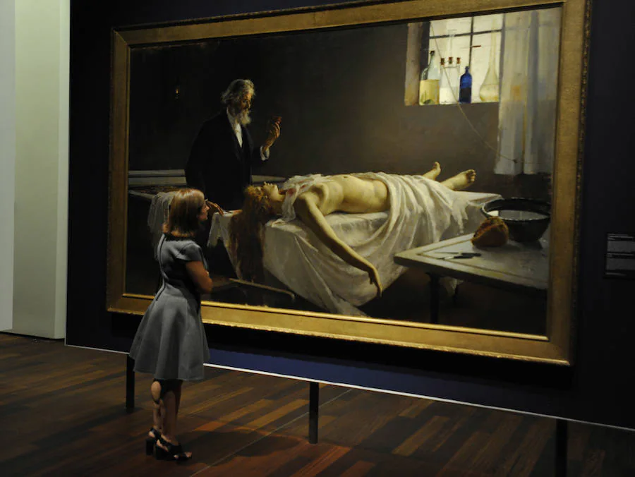 El cuadro más importante de la colección ¡Y tenía corazón!, de Enrique Simonet, que representa la autopsia de una prostituta y que envió en 1810 como estudio anatómico 