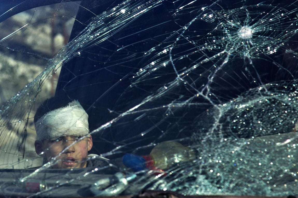 Un niño sirio herido en el interior de una ambulancia. 