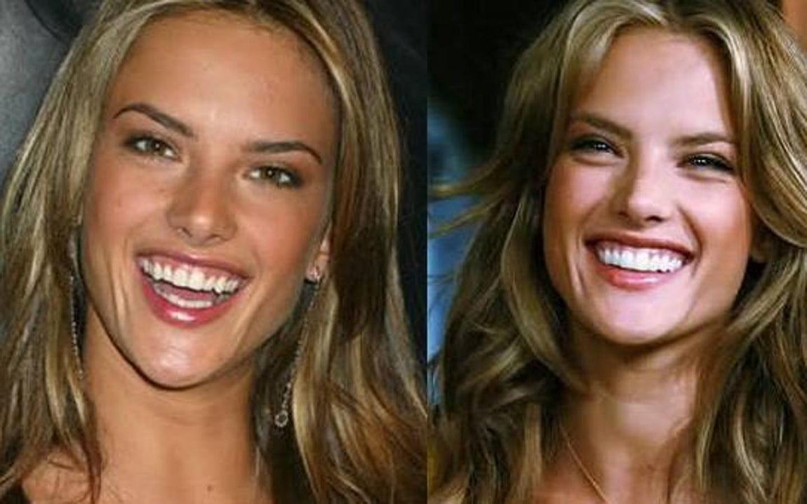 Alessandra Ambrosio. 